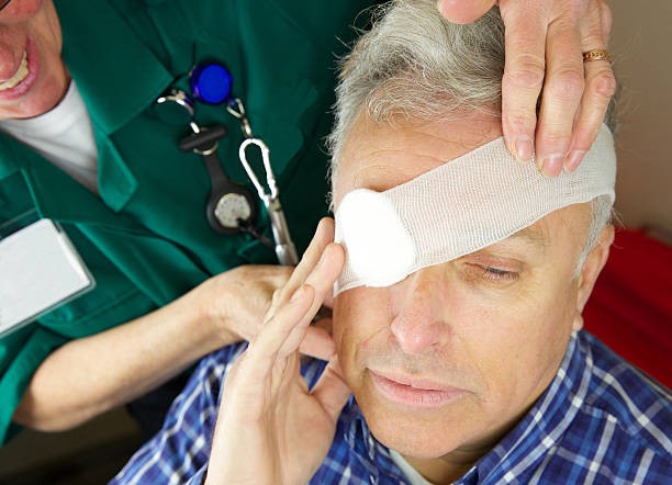 Xử trí chấn thương mắt tại nhà - Ảnh 1. Xử trí chấn thương mắt tại nhà - Ảnh 1.
