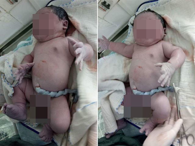 Bé sơ sinh 7,1 kg vừa chào đời ngày 14-10 và là em bé có trọng lượng sơ sinh lớn nhất từ trước đến nay ở Việt Nam - Ảnh: L.P