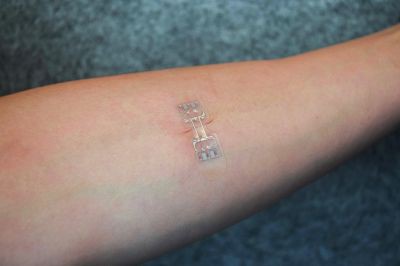 Băng dán microMend giúp đỡ phải khâu vết thương - Ảnh 1. Băng dán microMend giúp đỡ phải khâu vết thương - Ảnh 1.