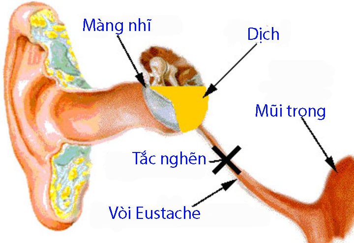 Bốn biến chứng thường gặp khi bé bị cảm lạnh - Ảnh 1.