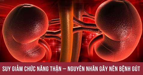 Trị gút mạn tính: tăng cường chức năng thận với Hoàng Tiên Đan - Ảnh 1. Trị gút mạn tính: tăng cường chức năng thận với Hoàng Tiên Đan - Ảnh 1.