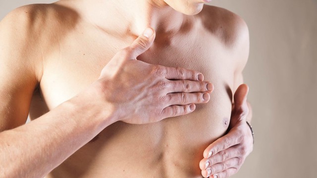 Nam giới ung thư vú, bị nặng mới biết - Ảnh 1. Nam giới ung thư vú, bị nặng mới biết - Ảnh 1.