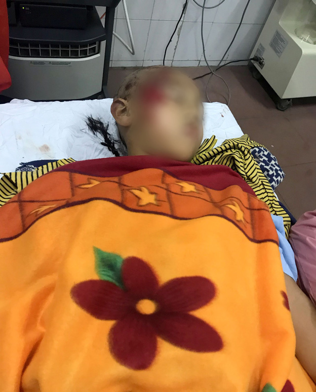 Sập lan can trường tiểu học, 11 học sinh bị thương - Ảnh 1. Sập lan can trường tiểu học, 11 học sinh bị thương - Ảnh 1.