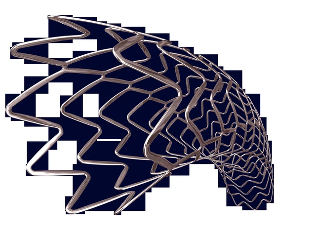 Stent an toàn cho bệnh nhân mạch vành - Ảnh 1. Stent an toàn cho bệnh nhân mạch vành - Ảnh 1.