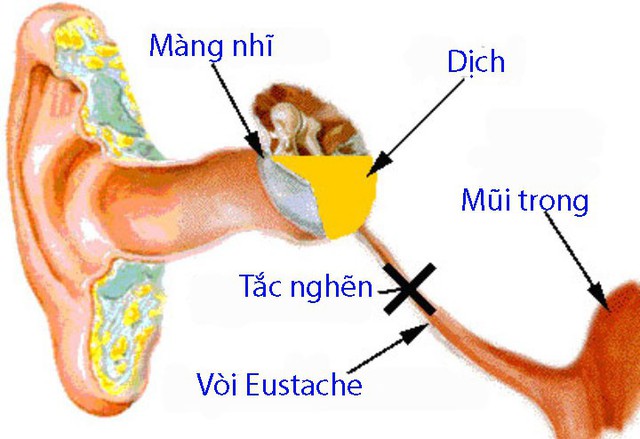 Bốn biến chứng thường gặp khi bé bị cảm lạnh - Ảnh 1. Bốn biến chứng thường gặp khi bé bị cảm lạnh - Ảnh 1.