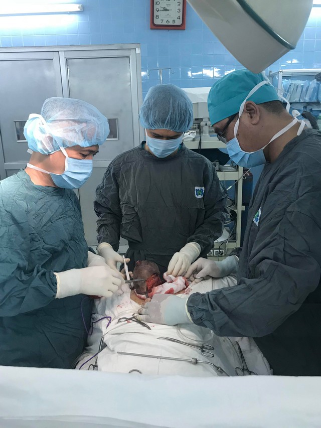 Phẫu thuật thành công khối bướu âm hộ đường kính 30cm - Ảnh 1. Phẫu thuật thành công khối bướu âm hộ đường kính 30cm - Ảnh 1.