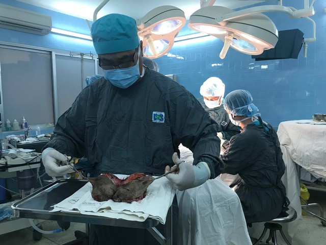 Phẫu thuật thành công khối bướu âm hộ đường kính 30cm - Ảnh 2. Phẫu thuật thành công khối bướu âm hộ đường kính 30cm - Ảnh 2.