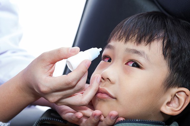 Điều trị các bệnh về mắt ở trẻ - Ảnh 1. Điều trị các bệnh về mắt ở trẻ - Ảnh 1.