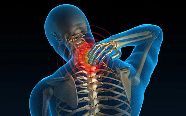 Đừng chủ quan với thoái hóa đốt sống cổ - Ảnh 1. Đừng chủ quan với thoái hóa đốt sống cổ - Ảnh 1.
