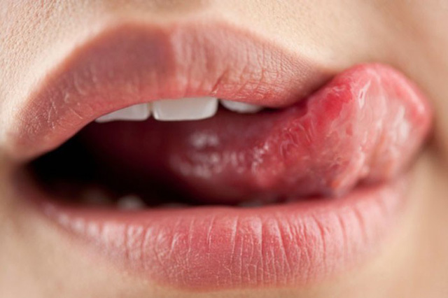 Vì sao môi lại bị thâm tím?
