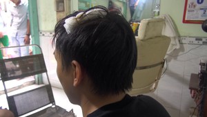 Con chó cắn nhân viên ghi chỉ số nước đã từng cắn người