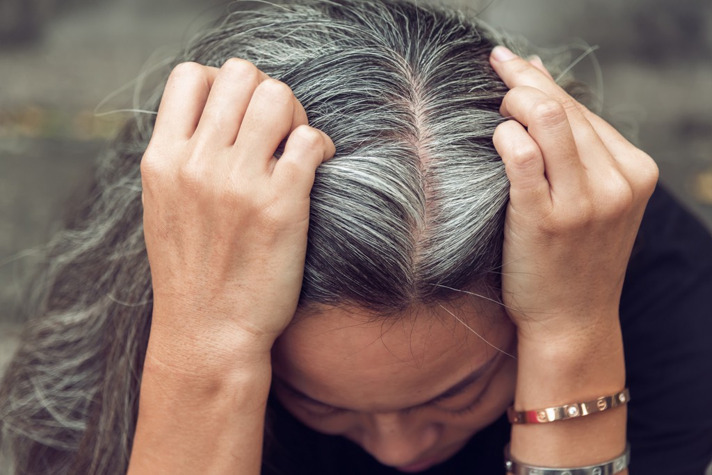 Bệnh tóc bạc sớm: Nguyên nhân và cách điều trị - Ảnh 1.