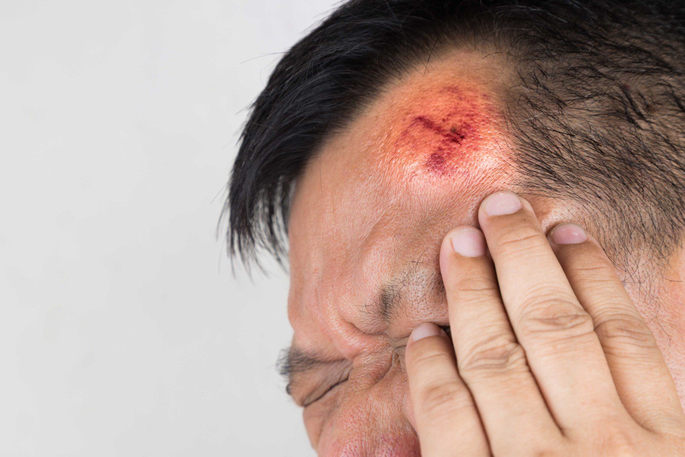 7 dấu hiệu cho thấy bạn cần đi cấp cứu sau một chấn thương đầu - Ảnh 1.