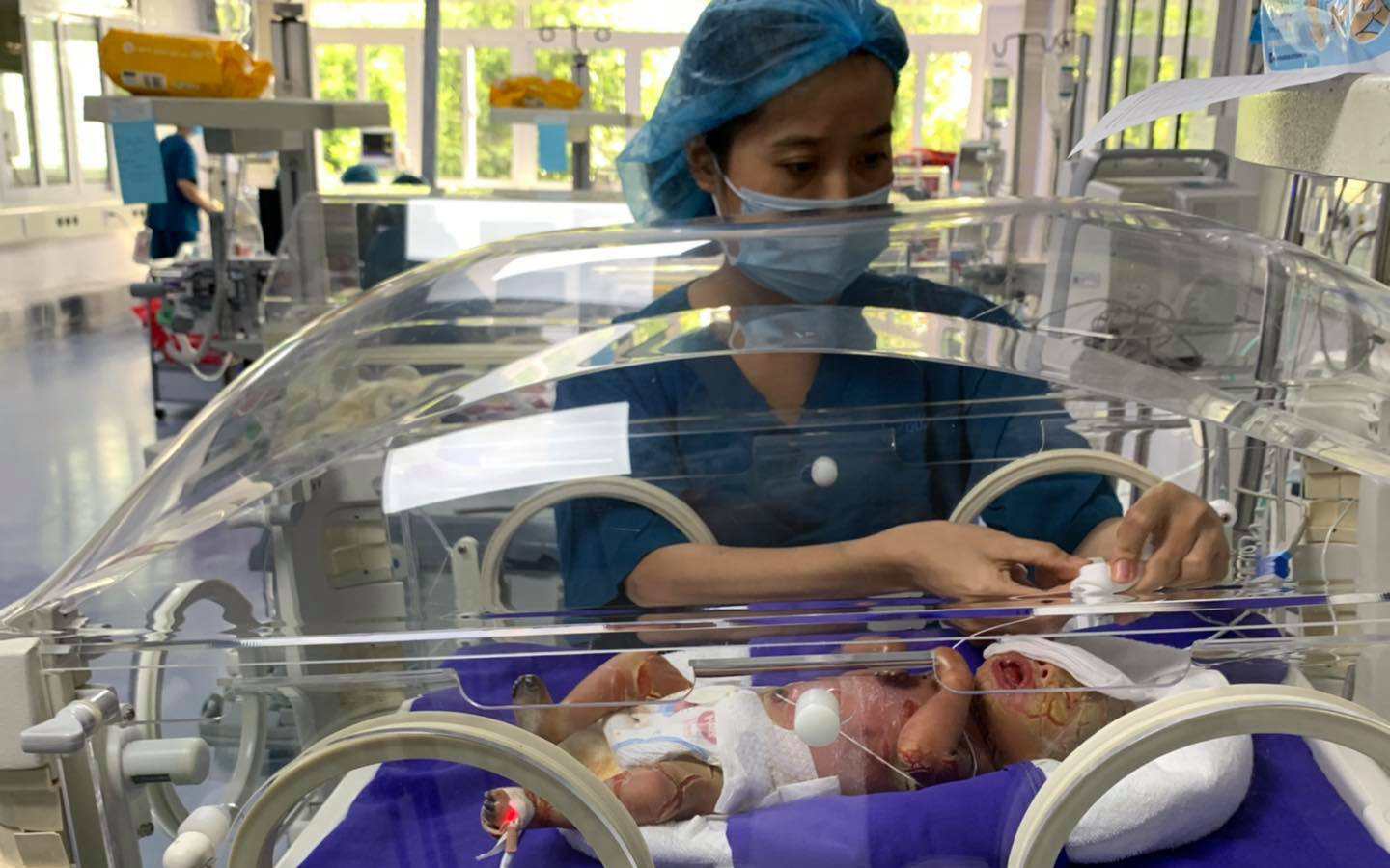 Cô gái Việt mắc bệnh hiếm được báo cáo đầu tiên trên thế giới- Ảnh 2. Bé trai mắc chứng da vảy cá toàn thân ở Quảng Ninh có cơ hội điều trị
