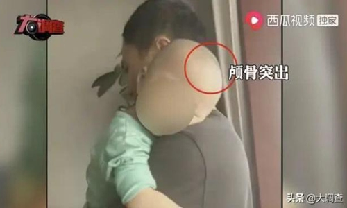 Trung Quốc điều tra vụ trẻ đầu to, còi xương vì uống sữa đặc biệt - Ảnh 1.