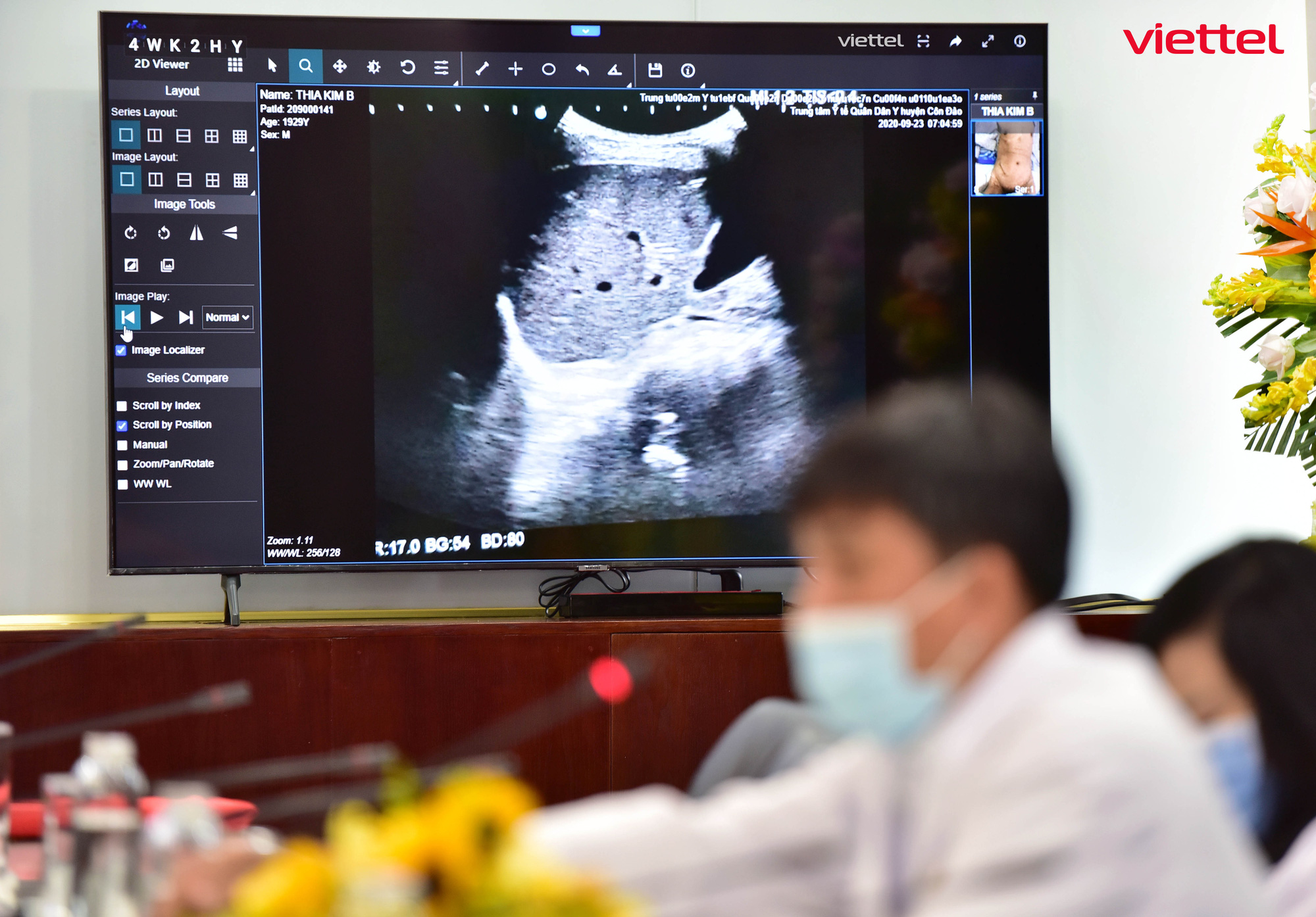 1.800 ca COVID-19 nặng được hội chẩn qua Telehealth - Ảnh 1. 1.800 ca COVID-19 nặng được hội chẩn qua Telehealth - Ảnh 1.