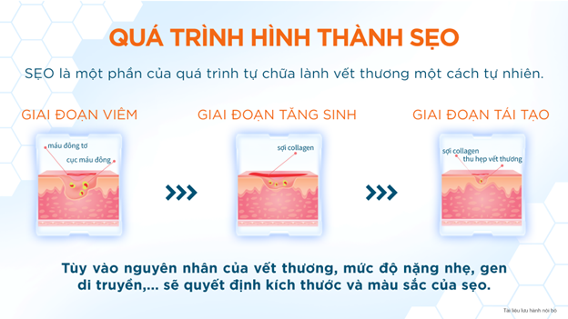 Gợi ý bí quyết để giảm sẹo trong bốn tuần - Tuổi Trẻ Online