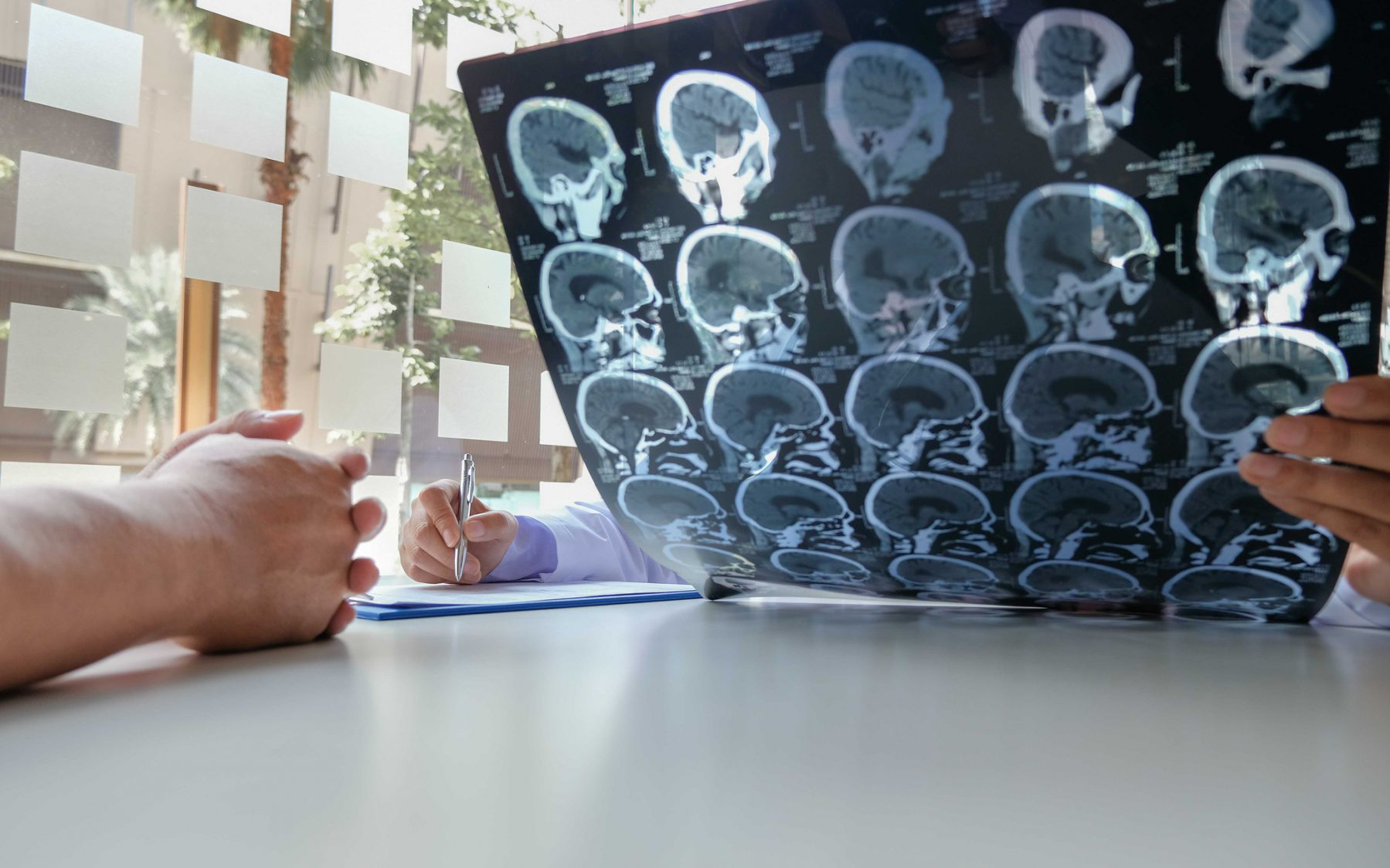 AI giúp chẩn đoán sớm và tìm ra phương pháp điều trị cho người đột quỵ