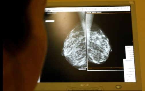 Mỹ tiêm thử nghiệm virus tiêu diệt ung thư trên người - Ảnh 1.