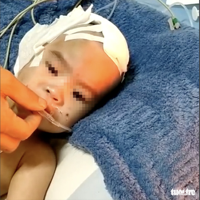 Bé gái bị chấn thương sọ não do 2 bảo mẫu bạo hành đã được xuất viện - Ảnh 1. Bé gái bị chấn thương sọ não do 2 bảo mẫu bạo hành đã được xuất viện - Ảnh 1.