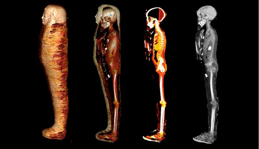Decoding the golden boy mummy after more than 100 years of being found - Photo 1.