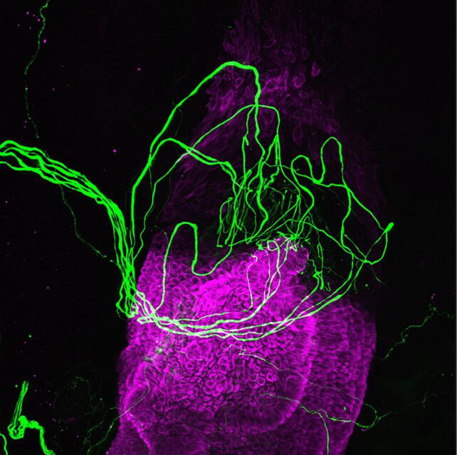A human hair follicle (pink) surrounded by sensory nerve endings (green) -Photo: Science Alert