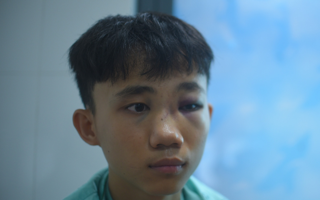 Nữ sinh lớp 8 bị chặn đánh hội đồng phải nhập viện- Ảnh 2. 1 nam sinh bị 10 bạn cùng trường đánh hội đồng gãy mũi phải cấp cứu