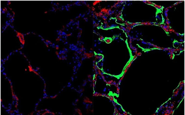 Phát hiện ra loại protein mới có thể ngăn chặn virus SARS-CoV-2