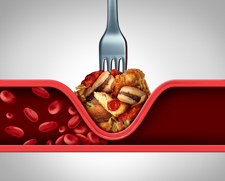 Chế độ dinh dưỡng thiếu khoa học khiến người dân bị mỡ máu cao - Ảnh: Shutterstock