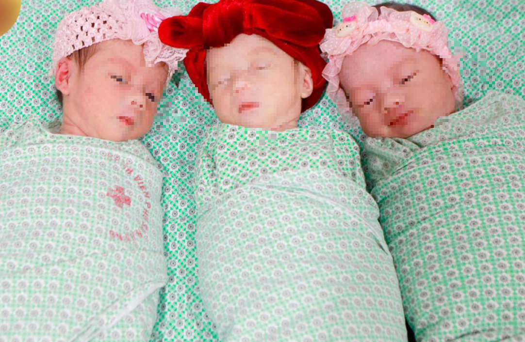 Rare identical triplets - Photo: Provided by the hospital