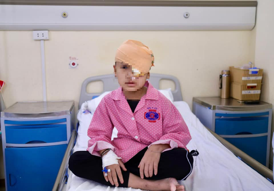 Surgery to remove the tumor that covered the whole face of a 4-year-old boy - Photo 1.