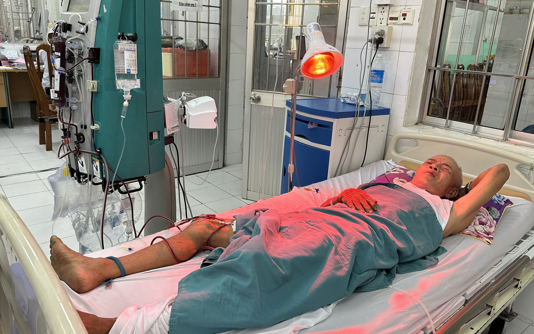 Chết vì ngộ độc rượu: Cảnh báo mãi vẫn lờn- Ảnh 2. Ngộ độc rượu ở đám tang, 5 người đi cấp cứu, có 1 người chết