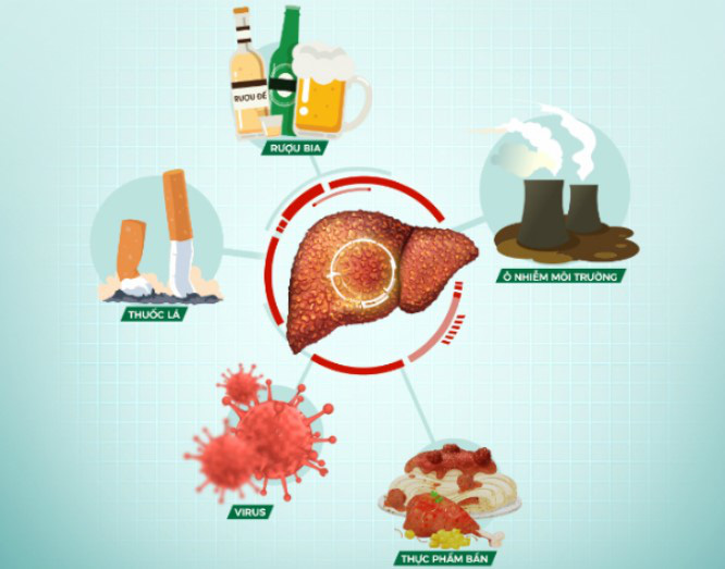 Gan là bộ phận quan trọng trong cơ thể và dễ bị tổn thương bởi nhiều yếu tố tác động - Ảnh minh họa