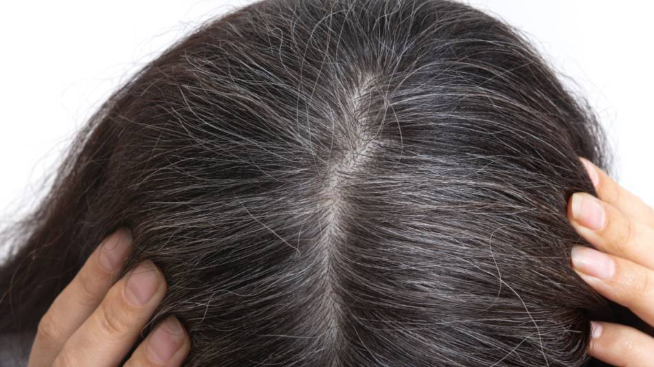 Tóc bạc phải nhuộm: Sẽ có lúc không cần làm thế nữa? - Ảnh 1. Phần lông hay tóc chúng ta nhìn thấy được bằng mắt thường ở bên ngoài da thực chất chỉ là phần tế bào đã "chết" - Ảnh minh họa: Consumerlab