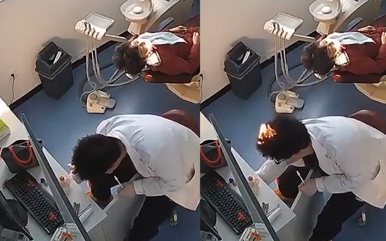 Bác sĩ nha khoa bị cháy tóc vì lơ đễnh