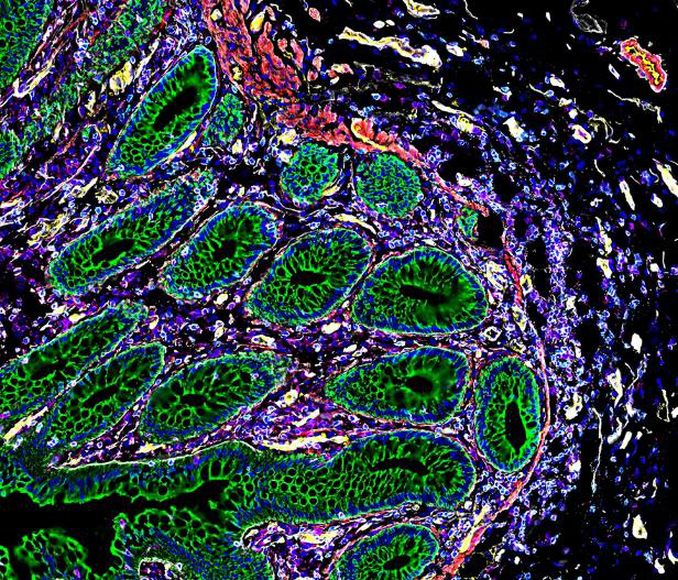 Các tế bào cụ thể trong ruột được đánh dấu bằng những màu khác nhau để làm nổi bật các loại tế bào khác nhau - Ảnh: STANFORD MEDICINE