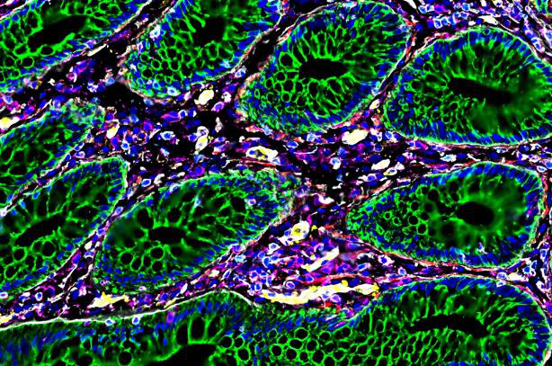 Cận cảnh protein, vi khuẩn, tế bào miễn dịch - Ảnh: STANFORD MEDICINE