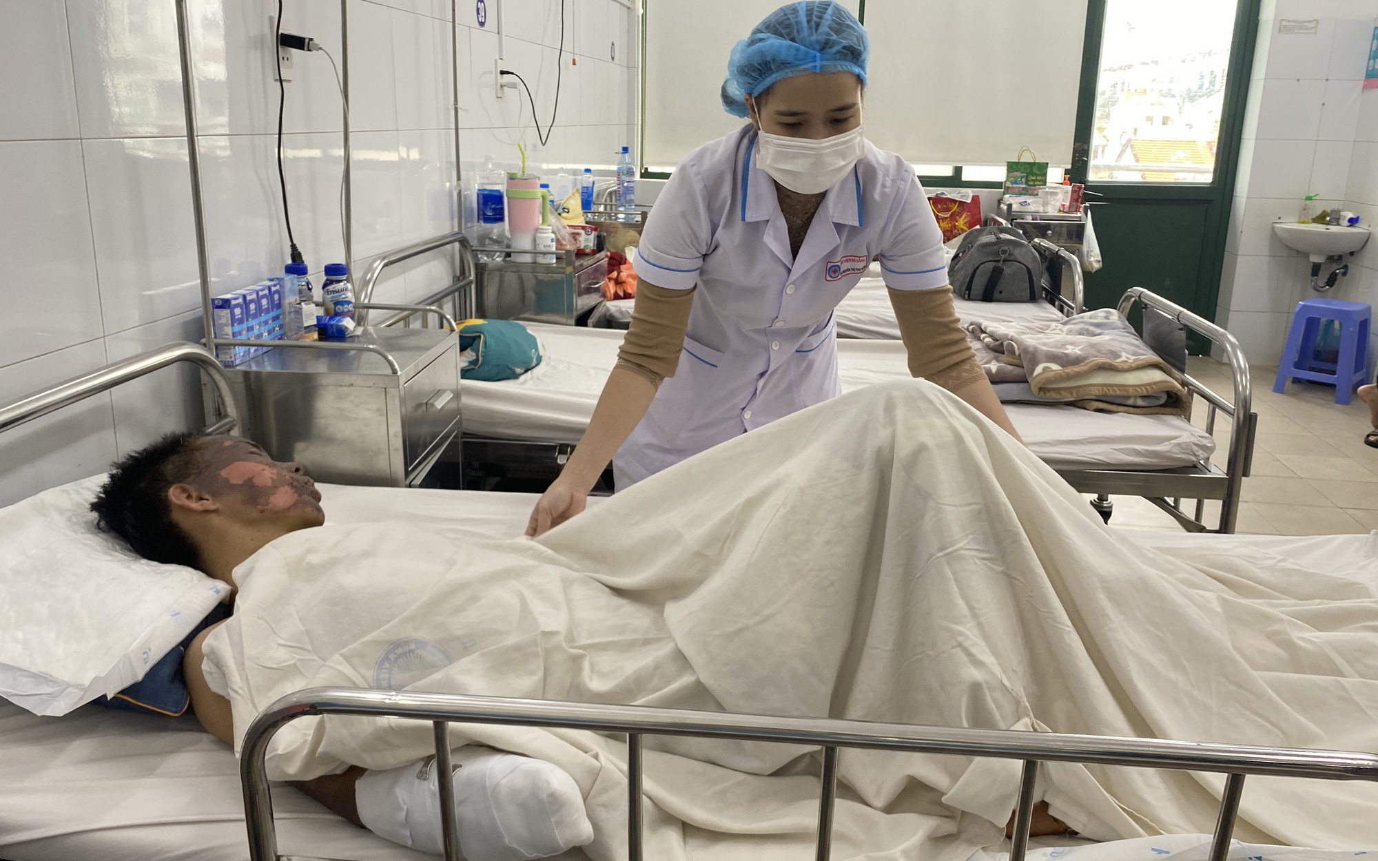 Bé trai 12 tuổi bị giập nát tay chân, vỡ ruột non vì chơi pháo nổ- Ảnh 3. Giập nát bàn tay, người