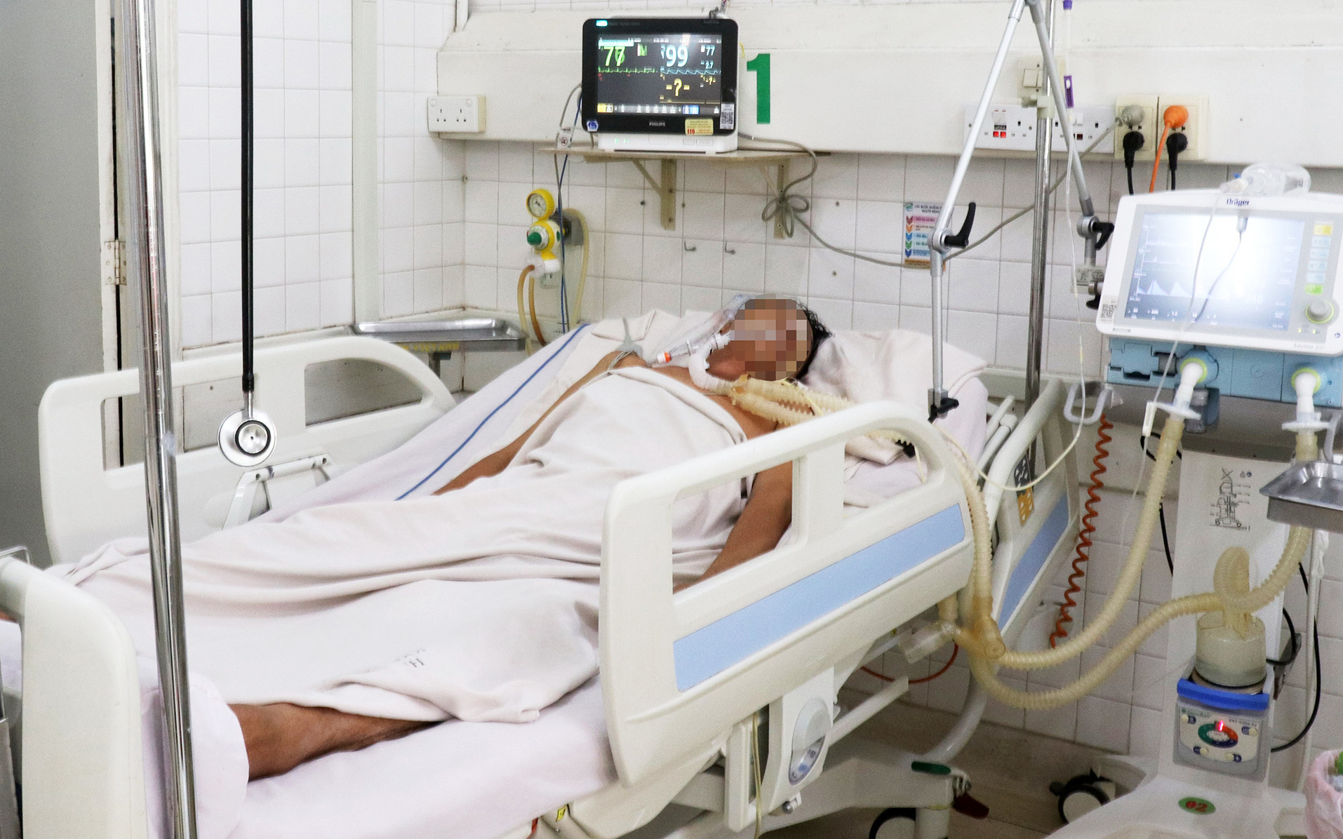Người bị chó mèo cắn và mắc bệnh dại tăng, TP.HCM ra văn bản khẩn- Ảnh 2. Bệnh dại bùng phát nhiều nơi, số người tử vong tăng mạnh
