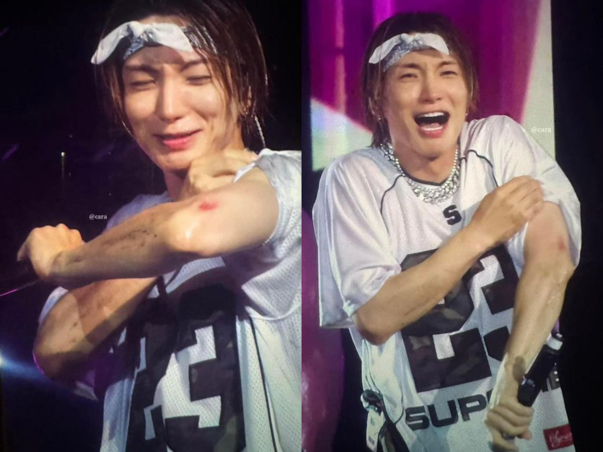 Leeteuk របួសដៃពេលសម្តែង - រូបភាព៖ អ៊ីនធឺណិត Leeteuk bị thương ở tay khi đang biểu diễn vào hồi tháng 10-2023 - Ảnh: Internet