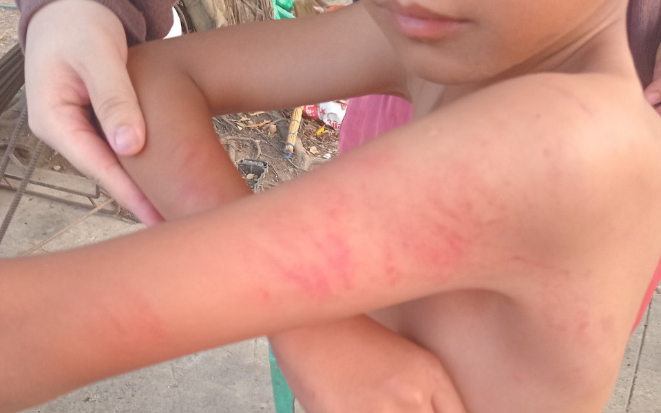 Vụ 'mẹ đến trường tát cô giáo': Phải chăng nhà giáo đang bị xem thường?- Ảnh 2. Con học lớp 1 bị cô giáo đánh, mẹ đến trường tát cô, chủ tịch huyện vào cuộc