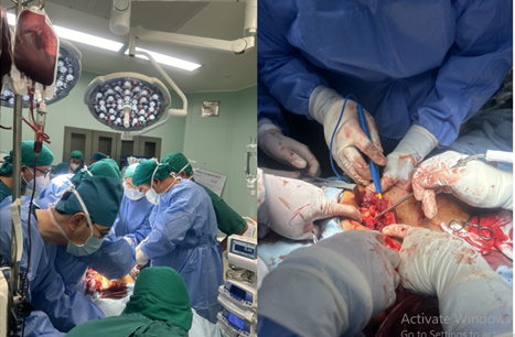 Bệnh viện Nhi đồng TP cứu sống một người lớn bị dao đâm vào ngực- Ảnh 1. Kích hoạt quy trình báo động đỏ liên viện gồm ê kíp Bệnh viện Nhân dân 115, Bệnh viện Trưng Vương, Bệnh viện Nhi đồng thành phố kịp thời cấp cứu cho nạn nhân - Ảnh: BV Nhi đồng TP cung cấp