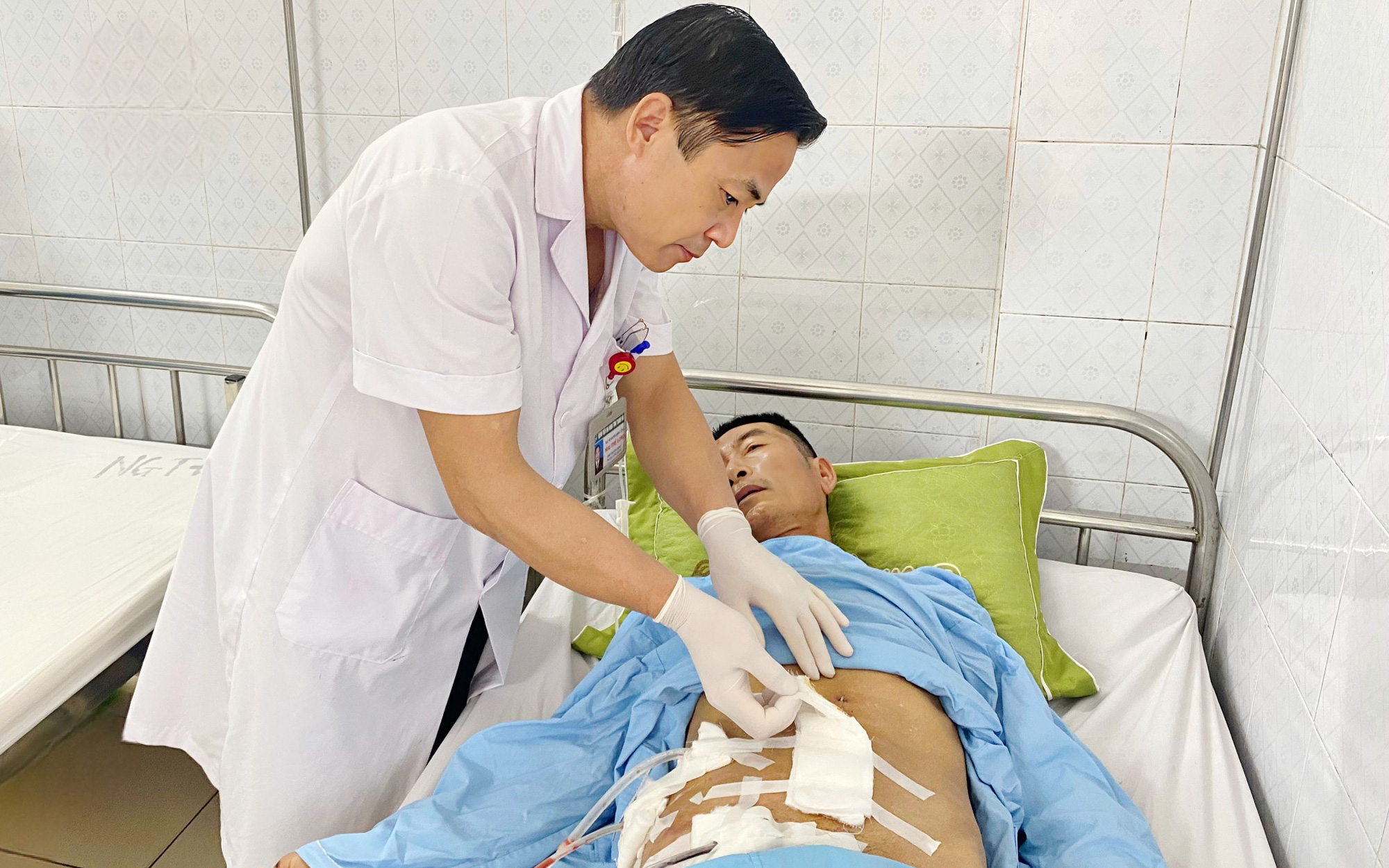 Mắc xương vịt 2cm ở thực quản và thanh quản, người phụ nữ không ăn không nói được- Ảnh 2. Chiếc xà beng dài hơn 1m đâm xuyên thành bụng người đàn ông 61 tuổi