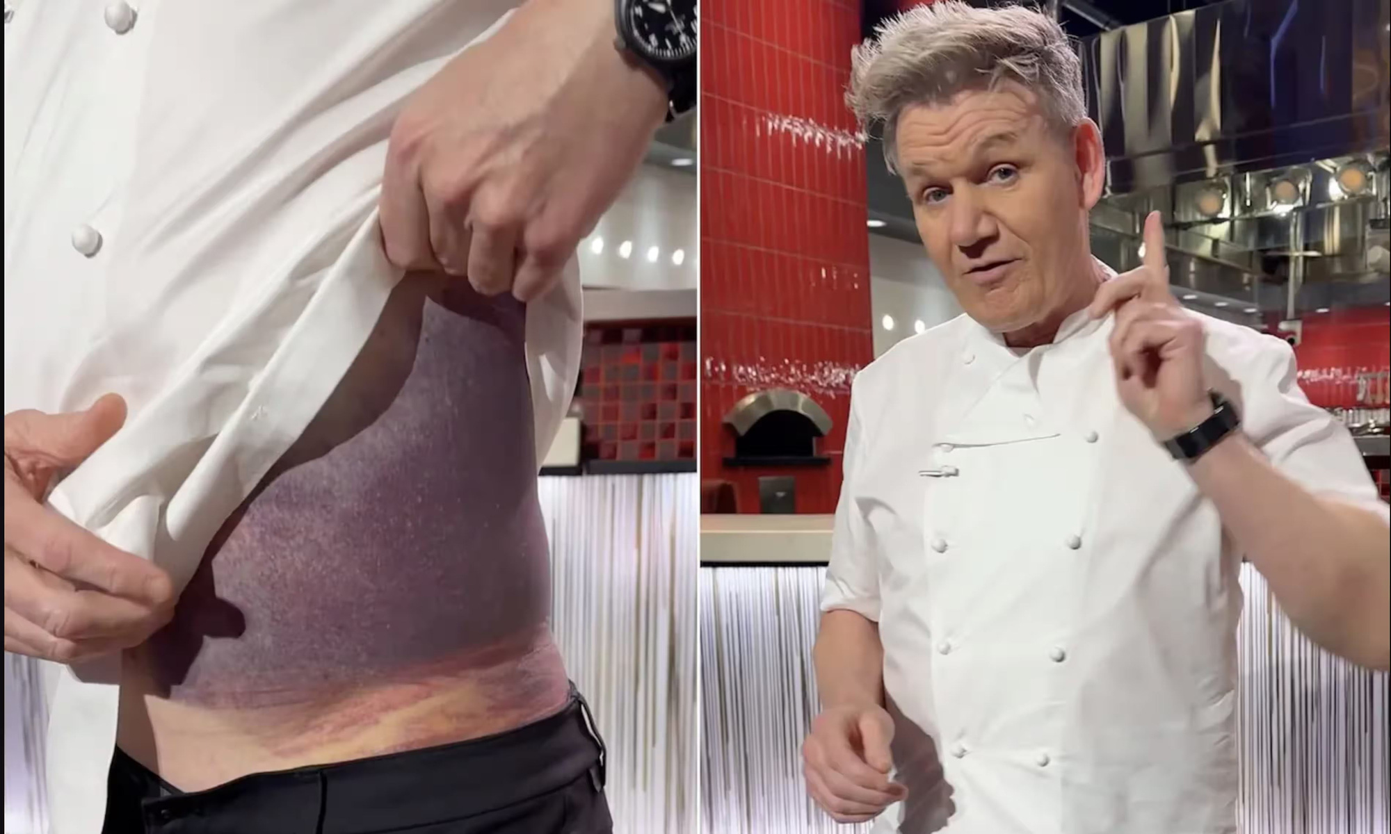 Đầu bếp Gordon Ramsay nói về tình trạng của mình sau tai nạn xe đạp nghiêm trọng ở Mỹ trong video vừa đăng tải trên trang cá nhân - Ảnh: Gordon Ramsey / Instagram
