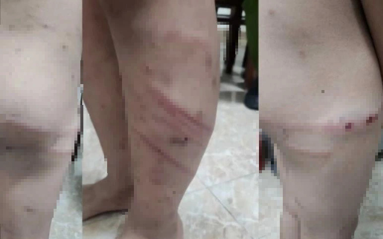 Mẹ bé trai bán vé số bị đánh chết: Chưa thấy mặt con lần cuối - Ảnh 3.