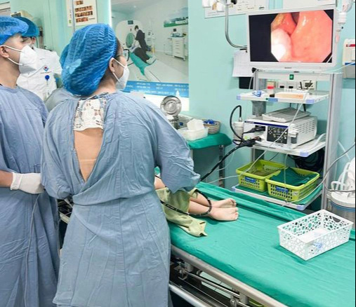 Mới 3 tuổi đã bị polyp đại trực tràng lớn chảy máu: Cách phát hiện sớm tránh ung thư- Ảnh 1. Nội soi cắt polyp cho bé 3 tuổi - Ảnh: BVCC