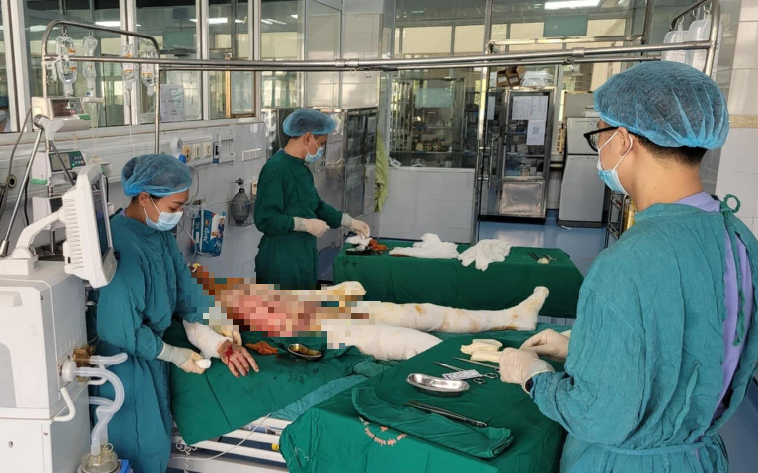 Thái Nguyên: Nghi nổ nồi hơi làm đậu phụ, 1 người chết, 2 người đi cấp cứu- Ảnh 2. Vụ nổ quán ăn sắp khai trương: 3 trong 8 người bị thương phải thở máy