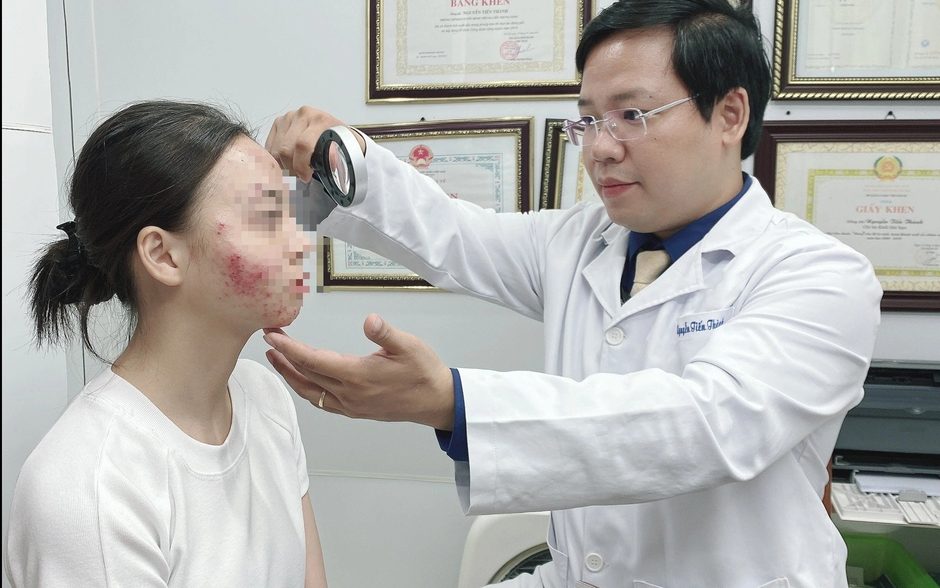 Cẩn thận với 'tam giác nguy hiểm' trên mặt, không nên tự ý nặn mụn- Ảnh 2. Uống thuốc tránh thai trị mụn, cô gái rước họa vào thân