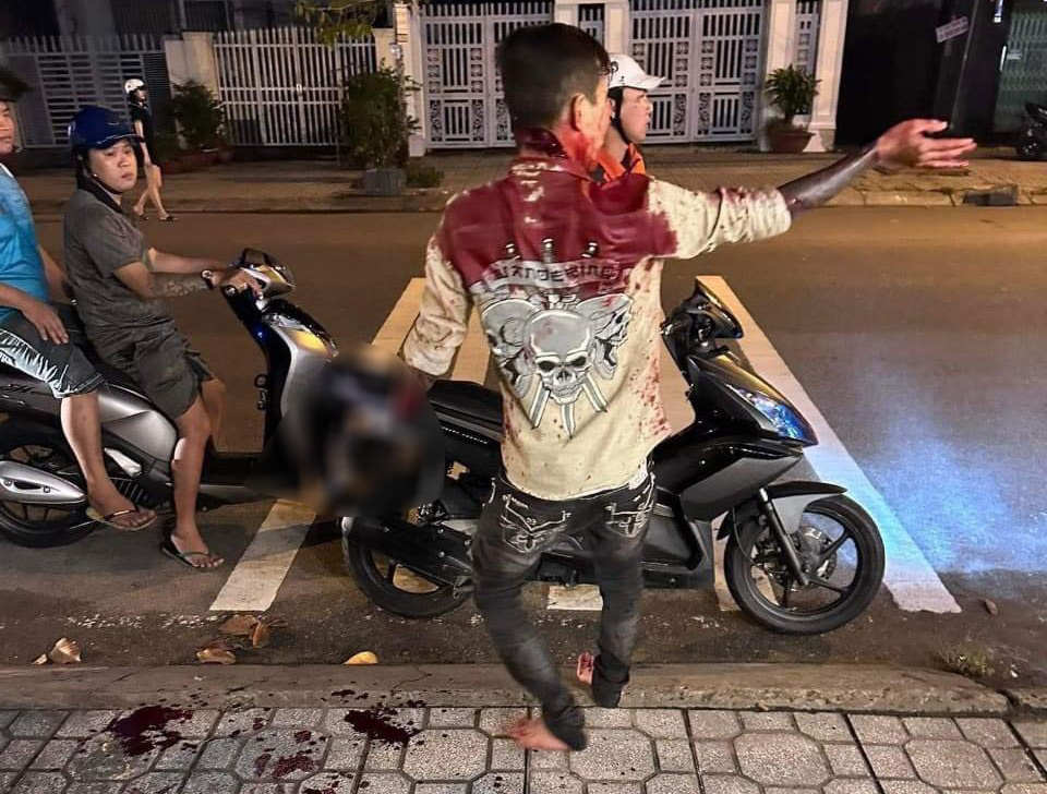 Bắt thêm 1 nghi phạm trong nhóm giang hồ được thuê chém chủ nợ- Ảnh 3. Chủ nợ chém con nợ đứt lìa bàn tay
