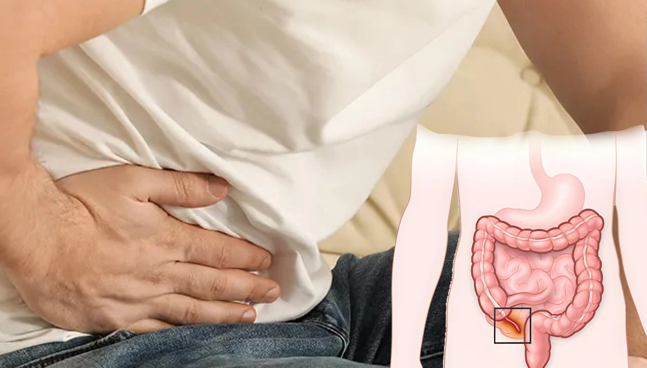 Viêm ruột thừa có thể nguy hiểm đến tính mạng nếu không được chẩn đoán kịp thời - Ảnh: Bệnh viện Hữu nghị Việt Đức